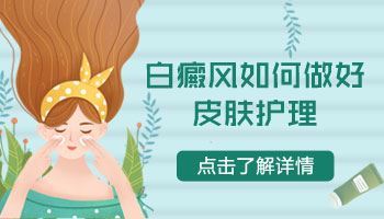 全身白癜风症状